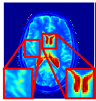mri
